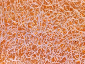 十年前她给他一杯鲜奶,十年后他给她----------_脱发食疗方