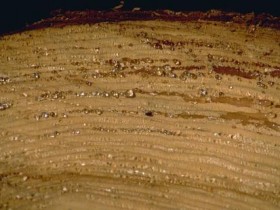 脱发五大真相揭秘,发友必知!_头发脱发严重